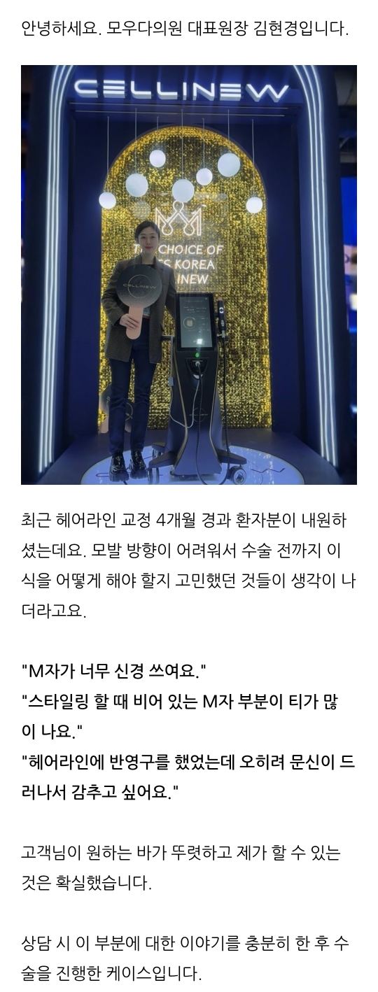 앞머리모발이식