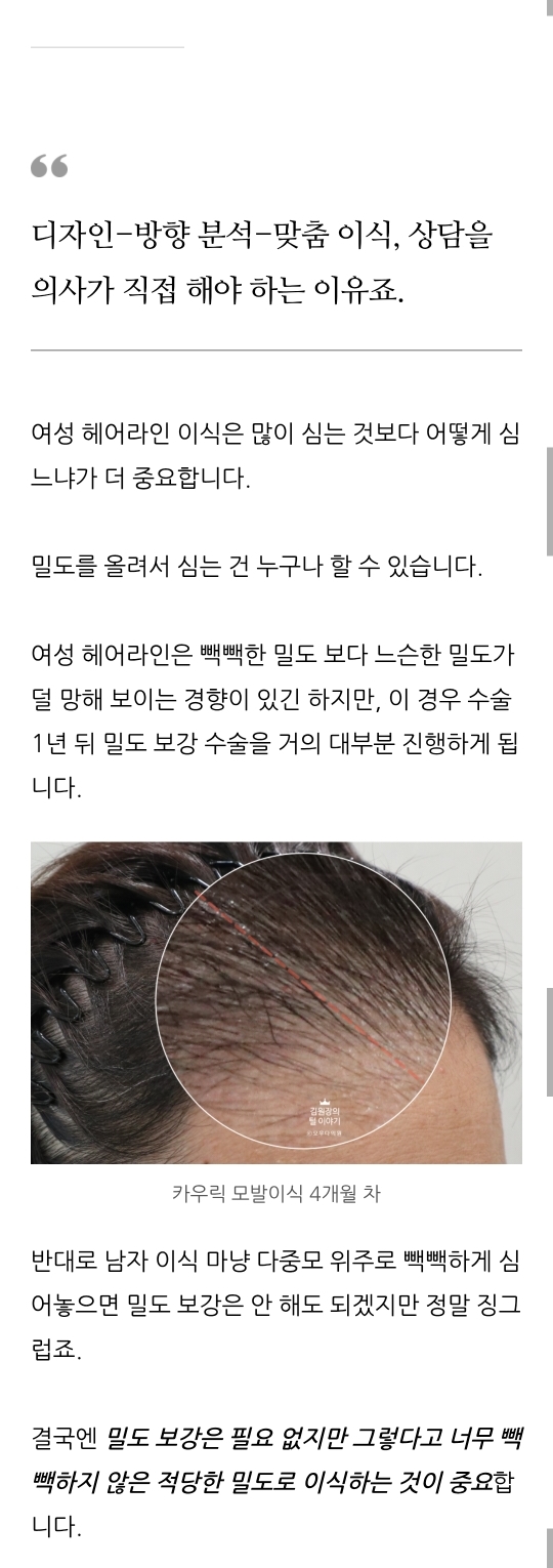 앞머리모발이식 디자인